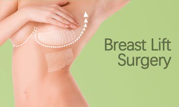 Breast Lift Surgery