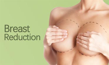 Breast Reduction